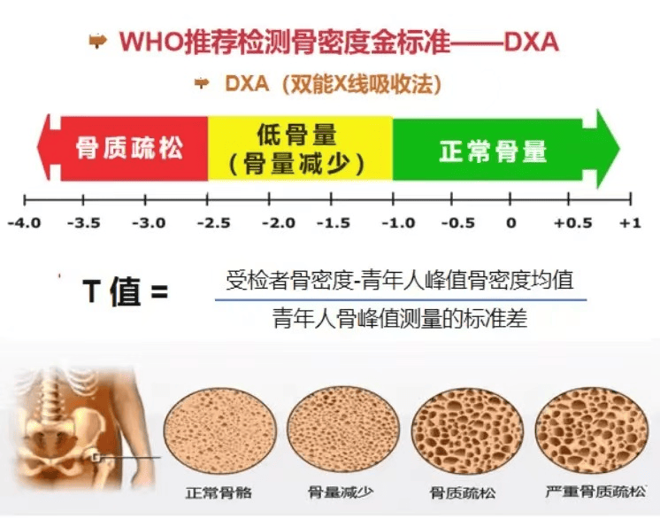 骨骼健康的守护者