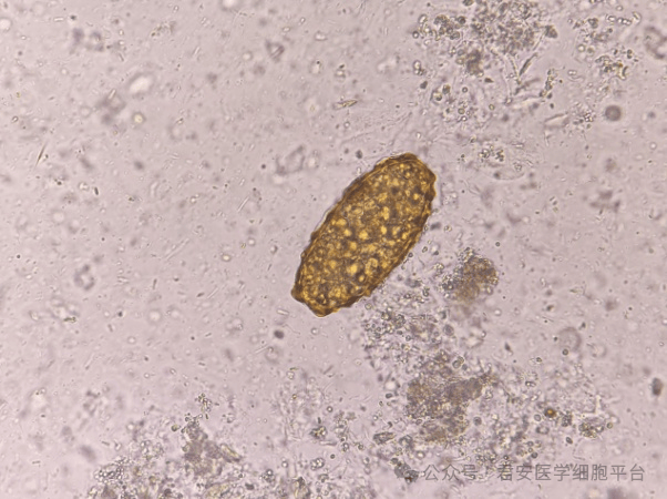 【知识集锦】蛔虫知多少?