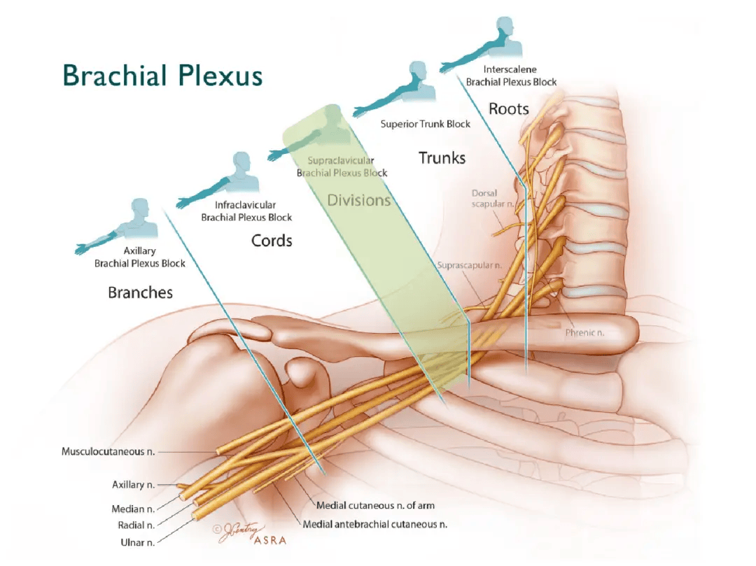 臂丛神经阻滞 定位图片