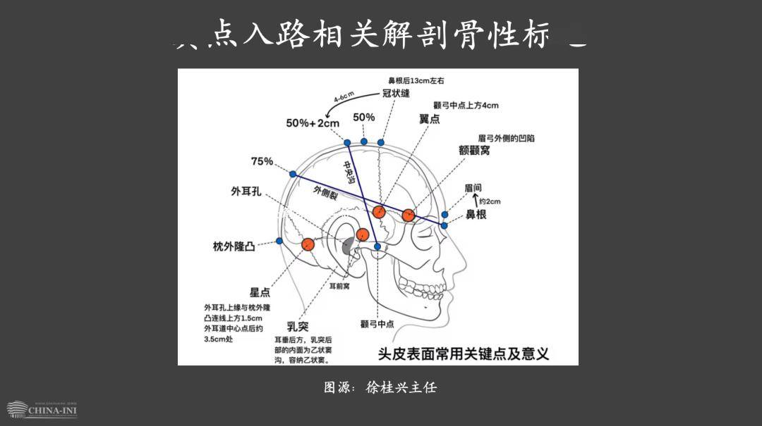 头颅缝隙解剖图片