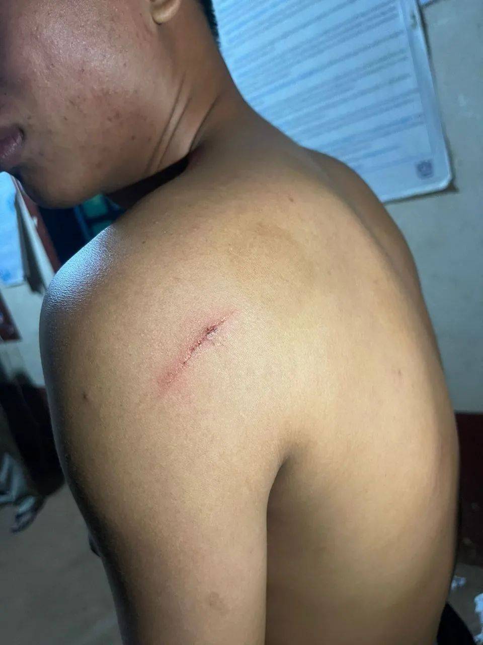 新婚日,一伙人冲进屋里将新郎及伴郎砍伤