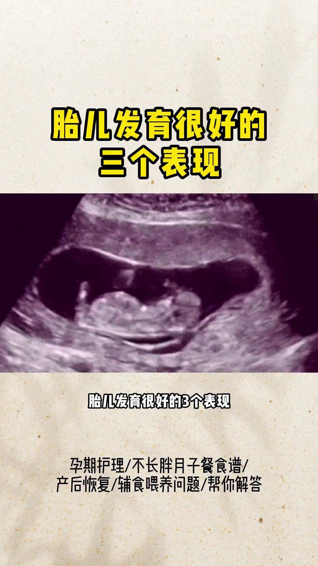 胎儿发育的很好的三个表现怀孕 孕期知识 一个身体两个心跳 四维彩超