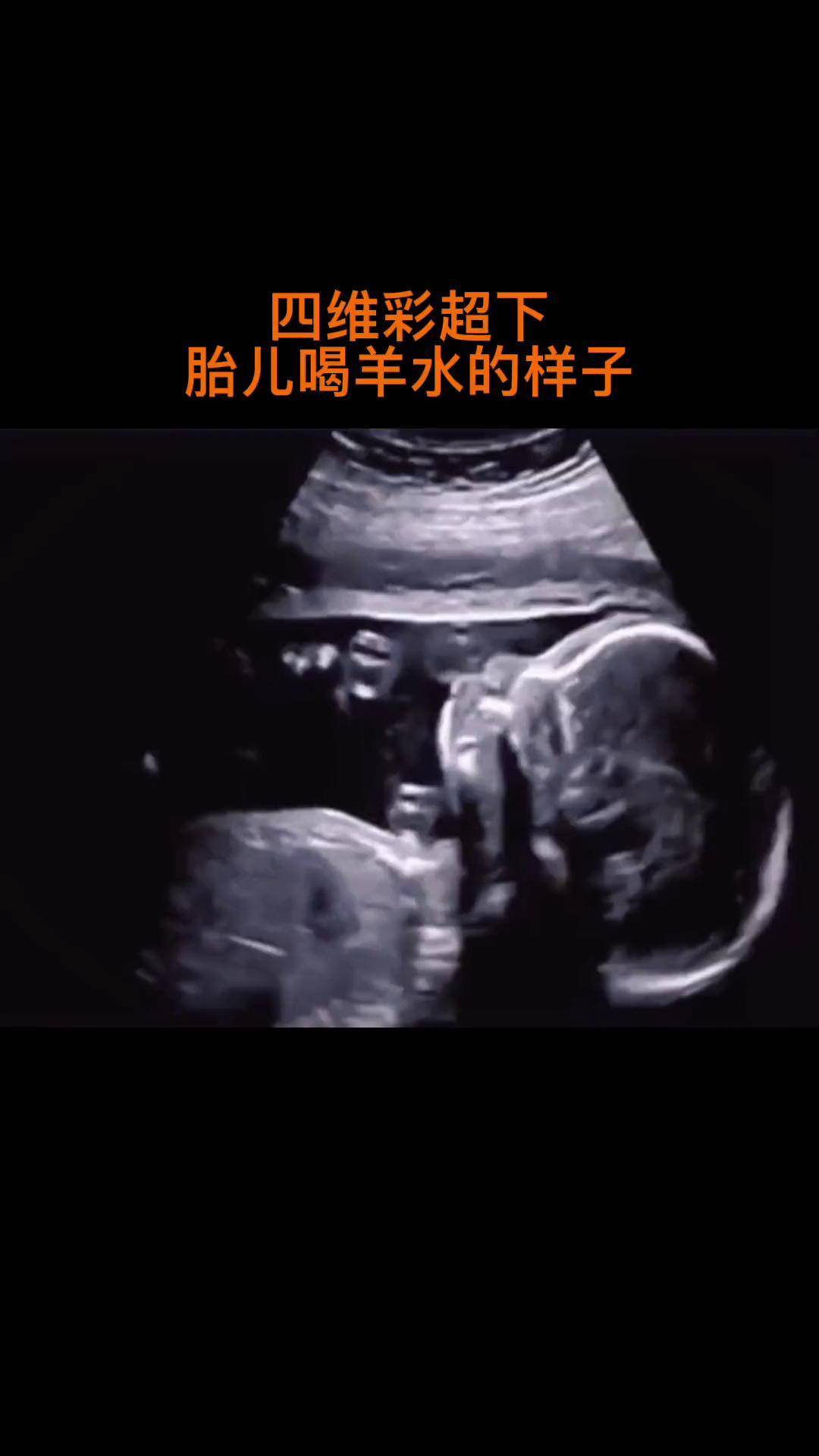 创作灵感胎宝喝羊水这也太可爱了胎儿羊水孕期好孕好孕
