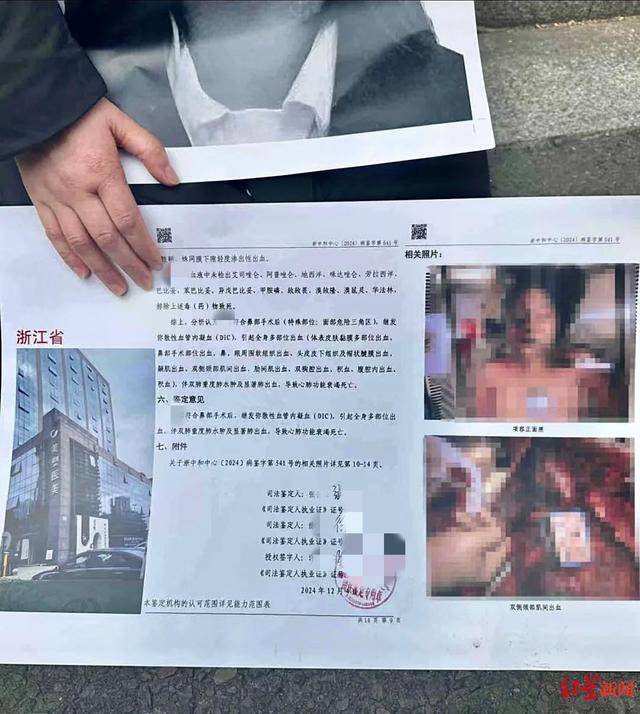 21岁女孩被曝做隆鼻手术后死亡，宁波鄞州区卫健局：已介入调查