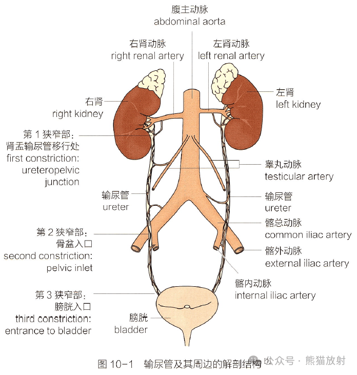 女性输尿管走形图片图片