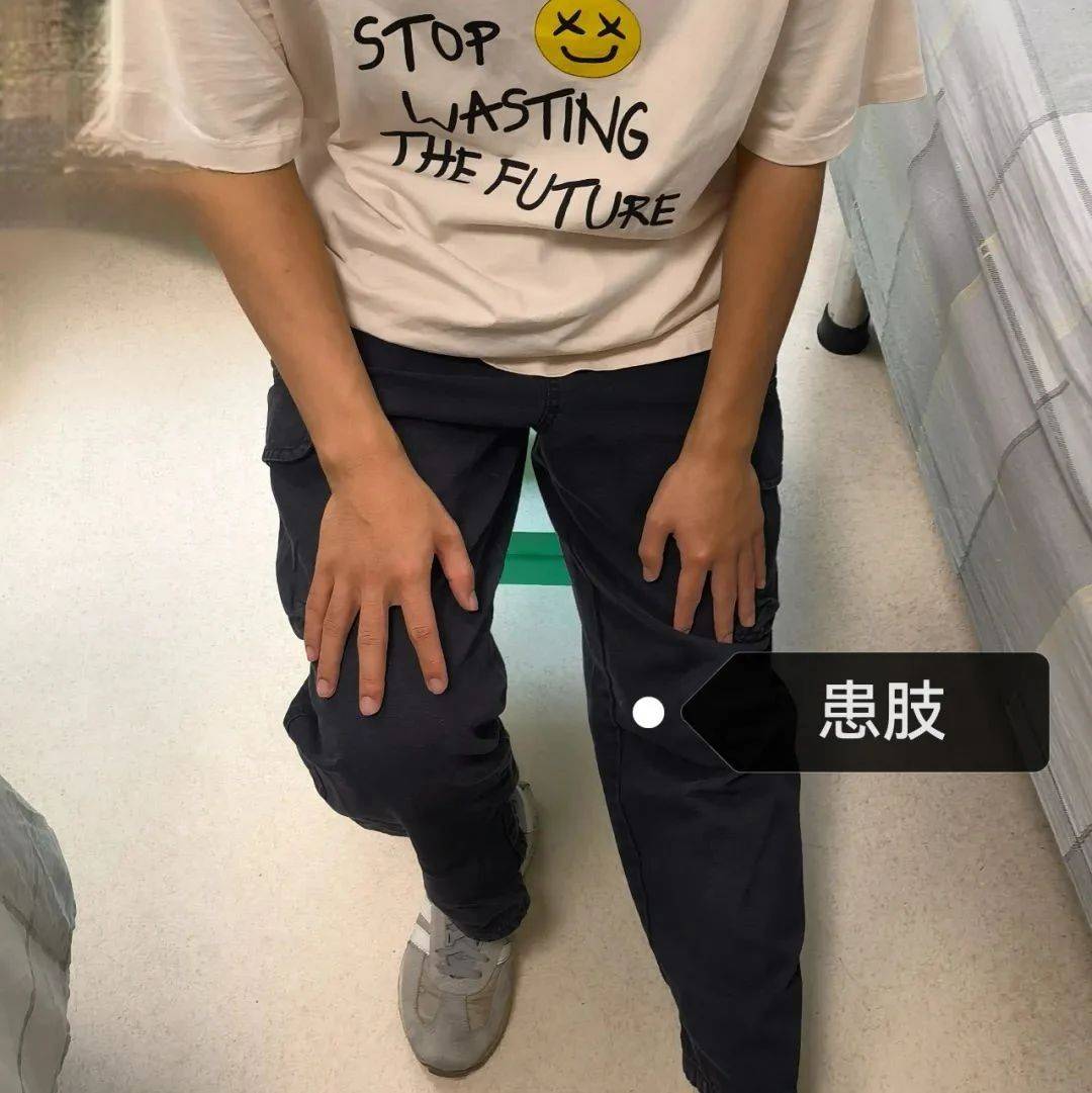 【科普】石狮市中医院:原来我们距离“恐动症”仅有一步之遥_髋关节_患者_训练