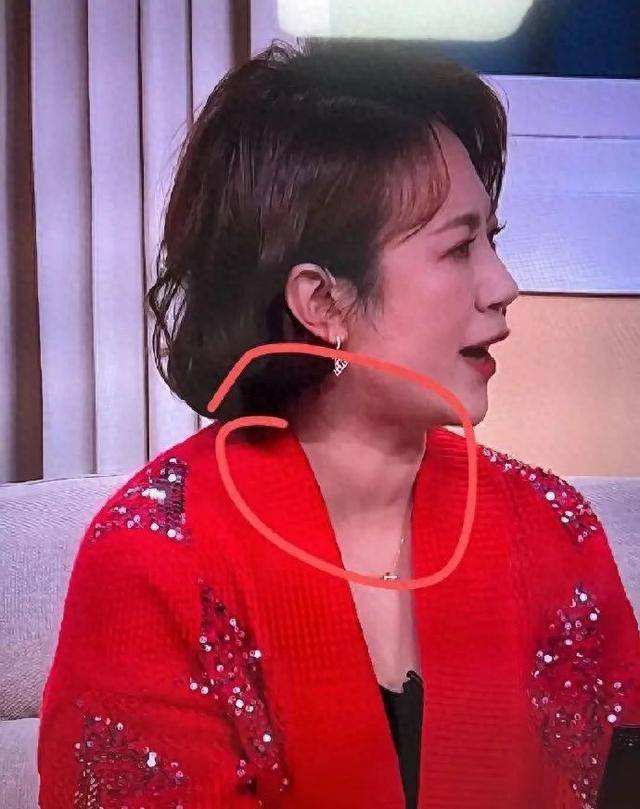春晚小品中马丽的甲状腺引关注！网友劝其做检查，本人曾回复粉丝：查了有结节