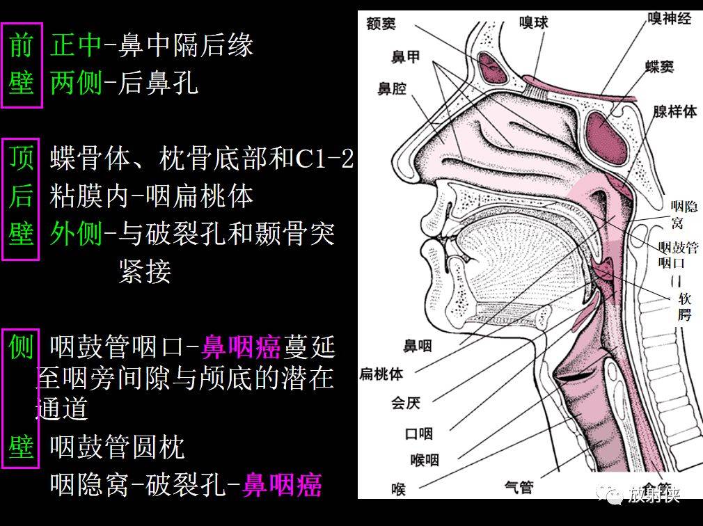 鼻咽部及ct的详细解剖图分析