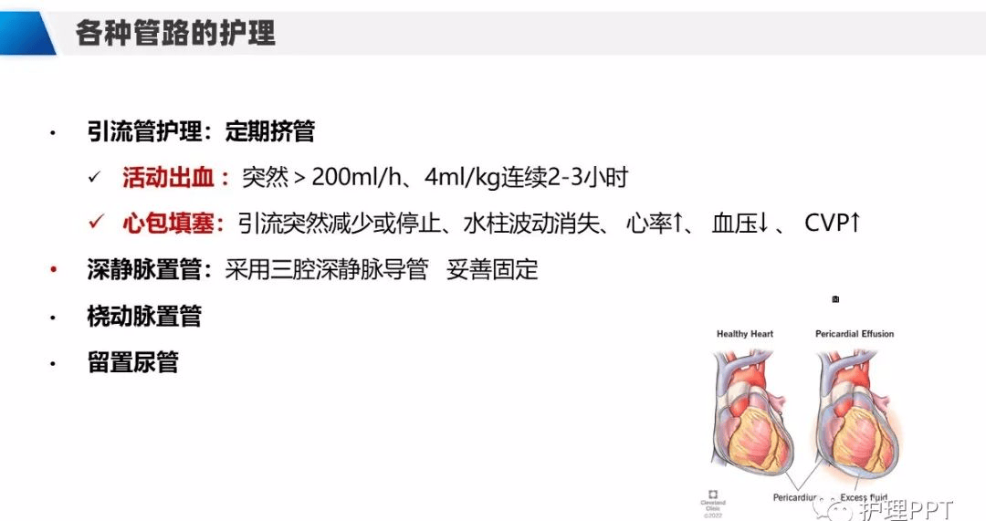 【ppt】冠脉搭桥患者护理查房（cabg）