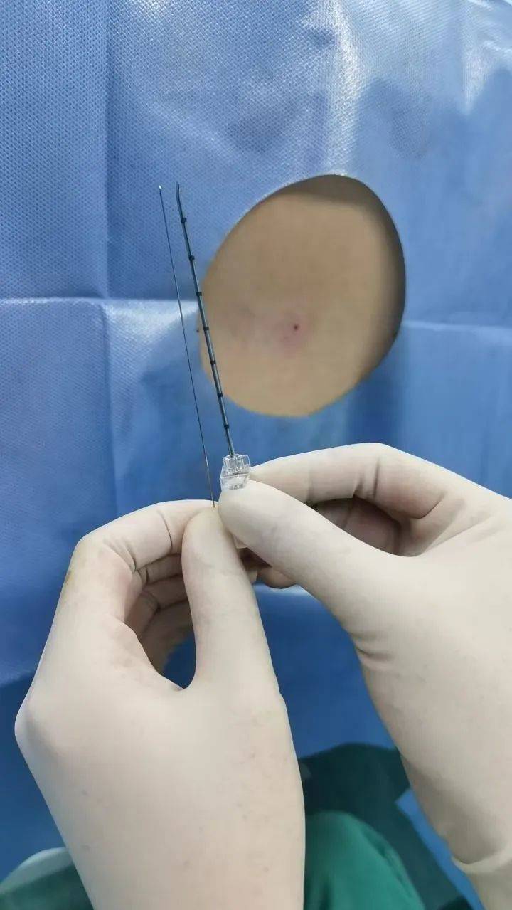 无影灯下的"乾坤圈":当麻醉医师遇上爱喝酒又肥胖的太乙真人,如何上演