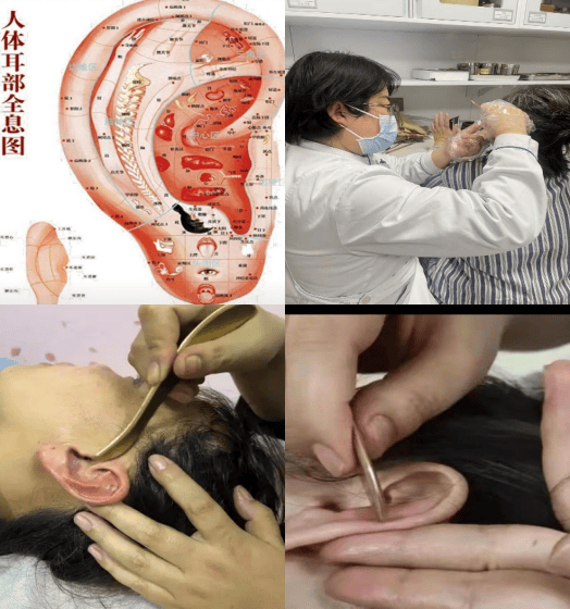 小耳朵,大智慧:耳朵里的健康乾坤