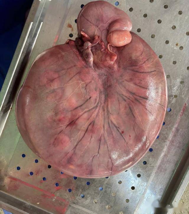 小吃店兼做胎盘加工:开在医院旁,单个胎盘八百元,称医院都知道