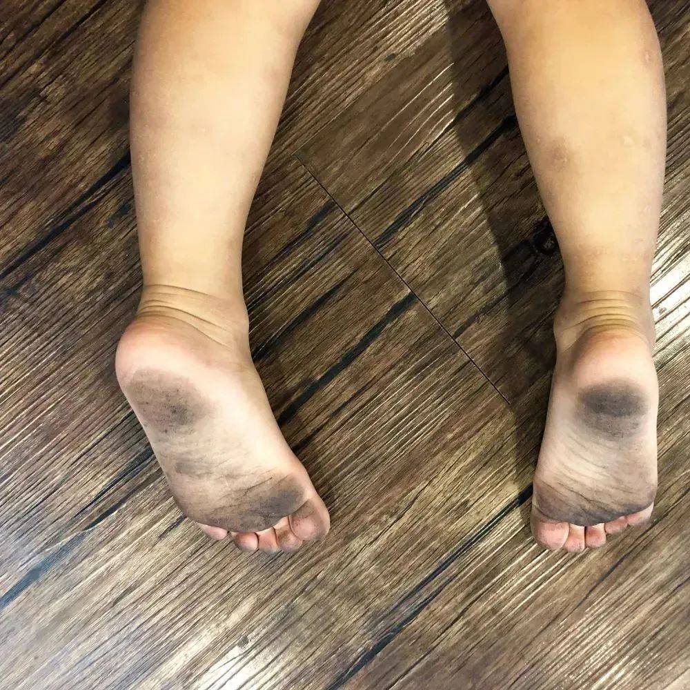 说真的,孩子爱光脚,真正的坏处只有一个!