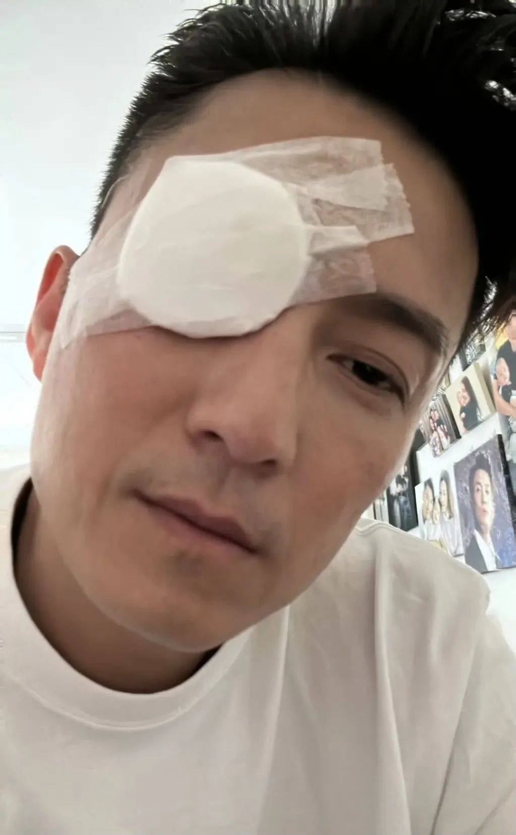 tvb视帝陈山聪自曝接受眼部手术,一只眼被纱布包裹,状态疲惫
