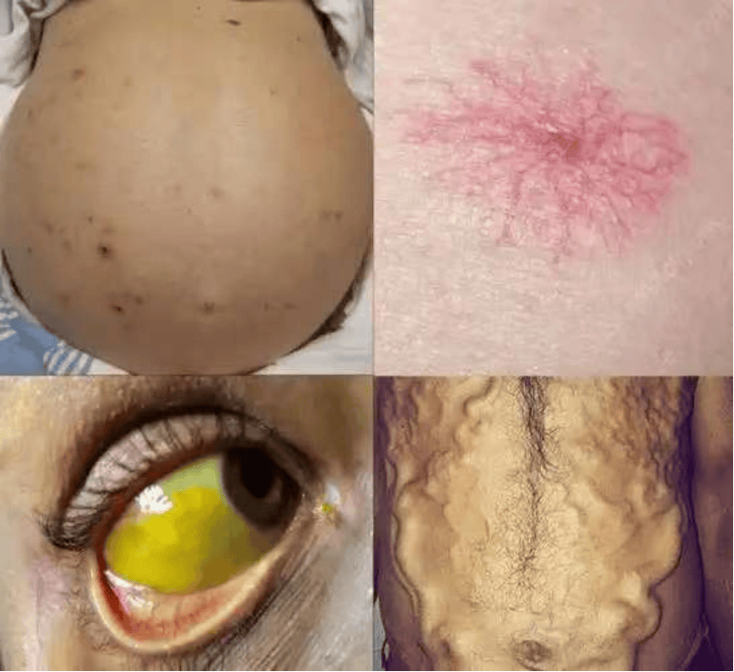 默默受伤的"小心肝"