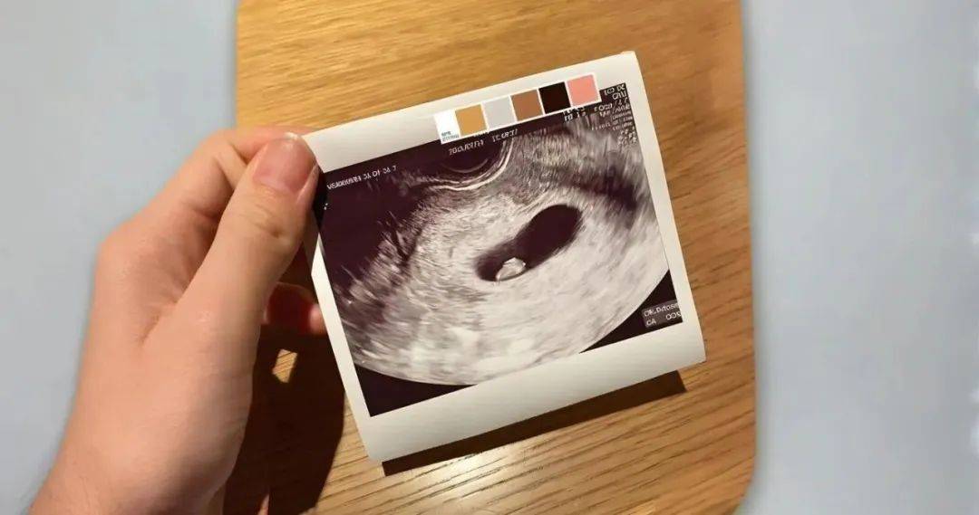 一般情况下,怀孕5周以后,b超可看见小胎囊,胎囊约占宫腔不到1/4,或