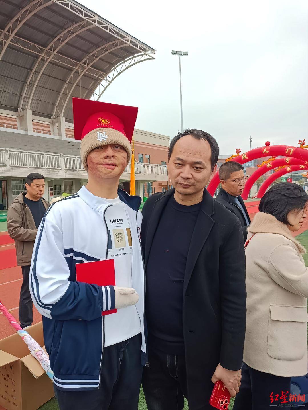 “烧伤男孩”高考664分被东南大学录取：曾经历23次手术，计划未来读研读博