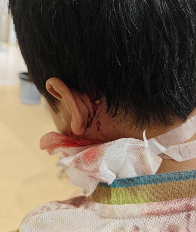 9岁男孩去同学家串门被拴住的狗咬伤引赔偿纠纷，狗主应担责吗？律师释法