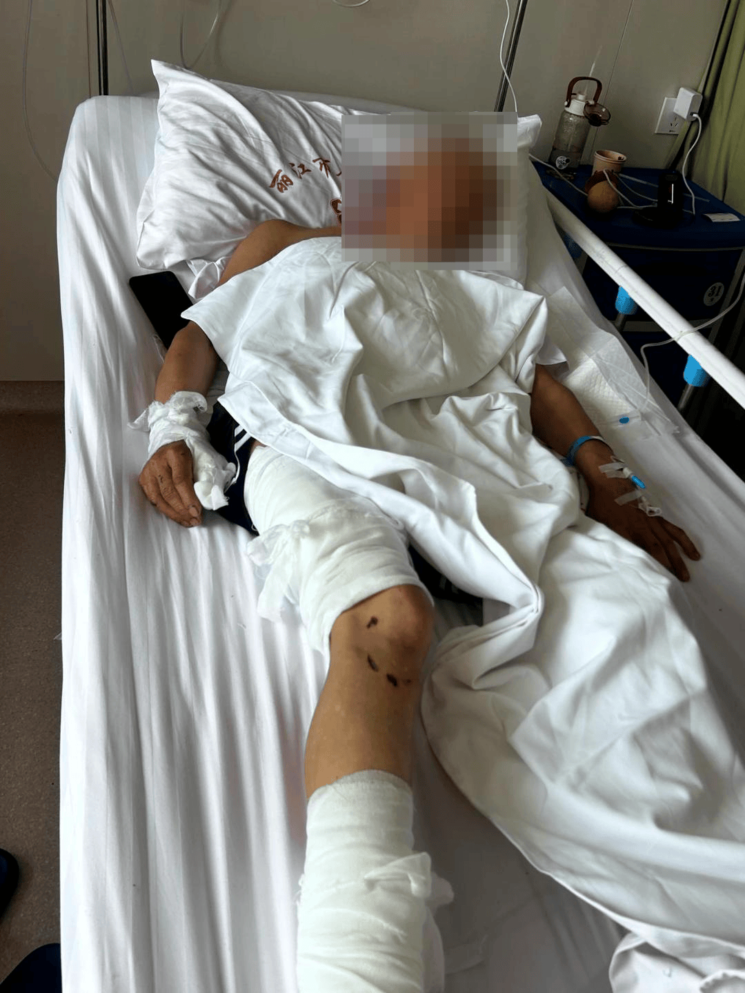 香格里拉一村民遭黑熊袭击：被拍晕昏迷受伤进ICU，熊去追滚落的背包才逃过一劫