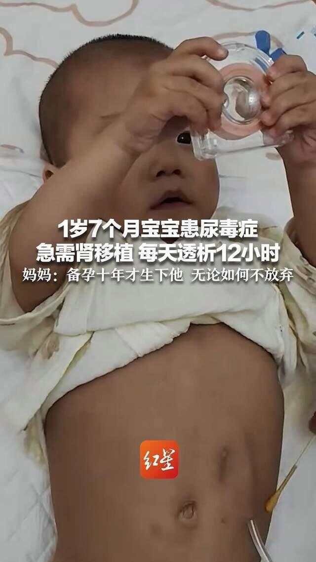 一岁七个月宝宝患尿毒症，急需肾移植手术；妈妈：备孕10年生下他，无论如何不放弃