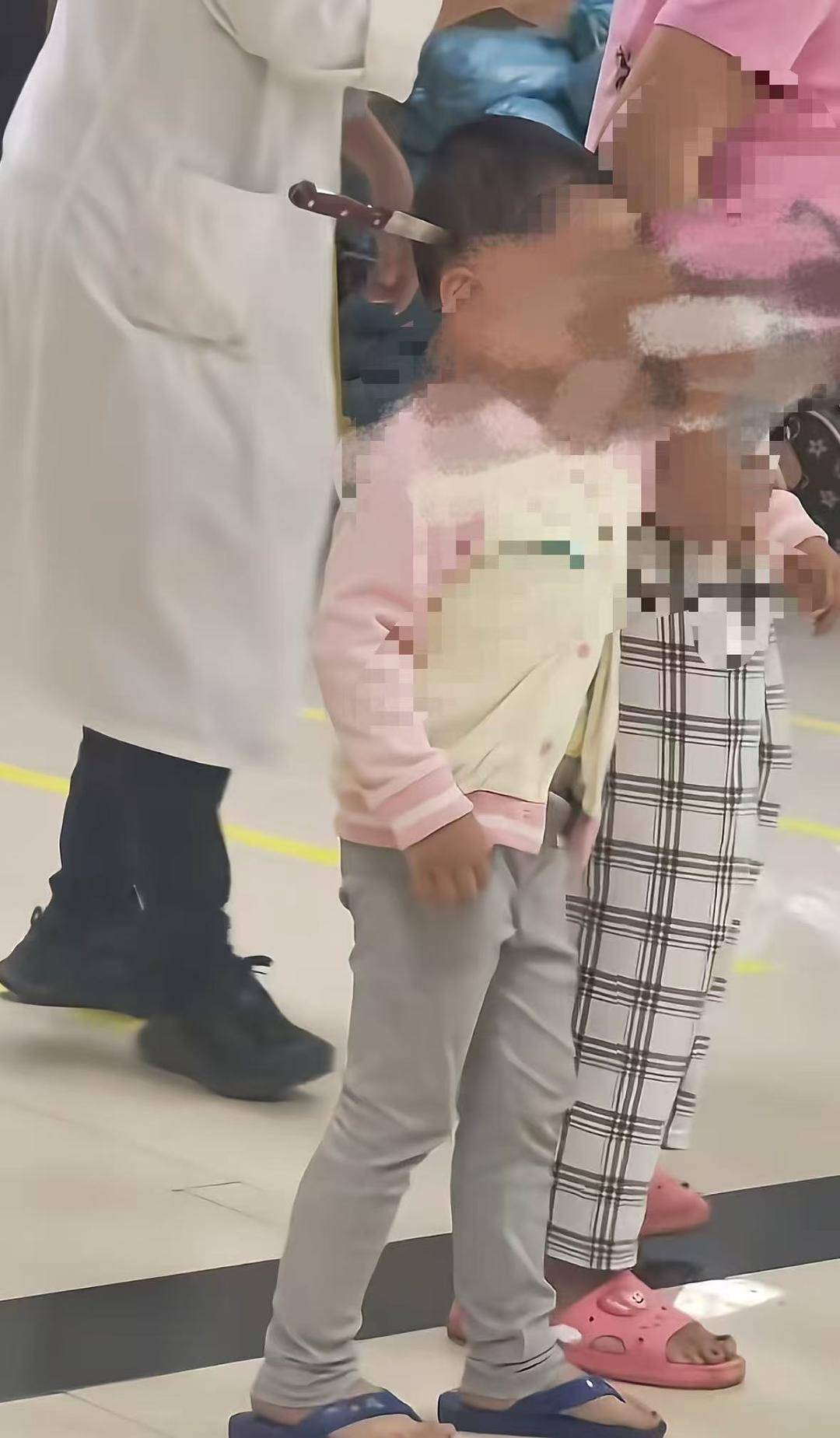 云南“头上插刀”女童淡定走进医院后续：已手术成功取刀 女童身体情况稳定