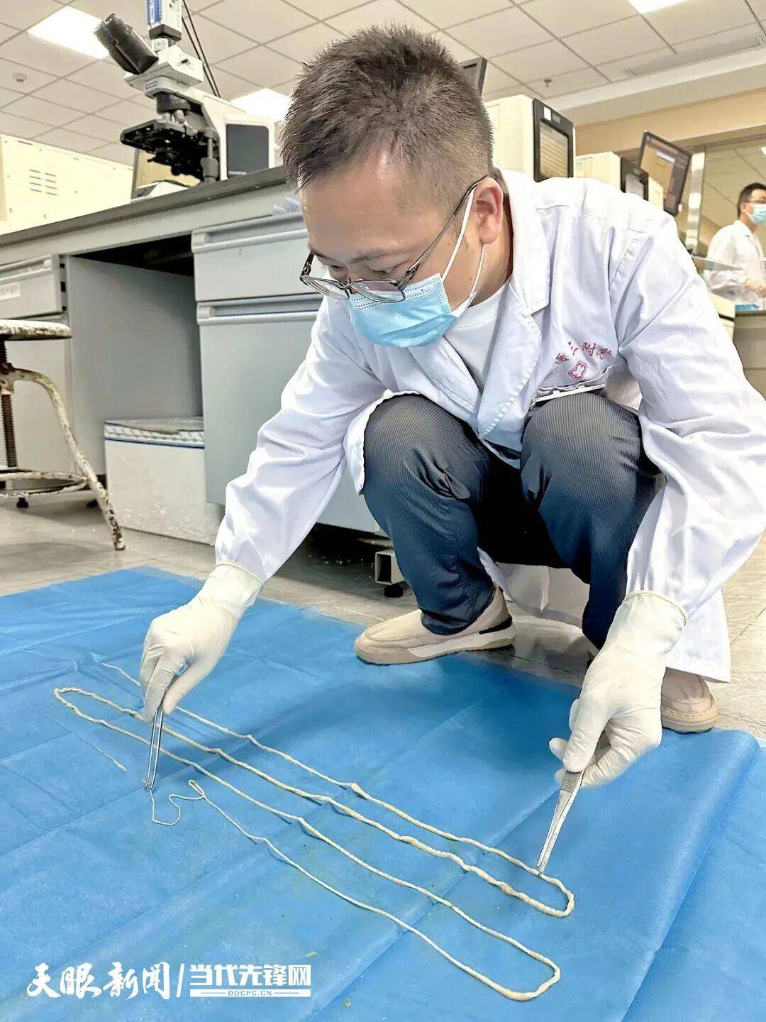 最长4米！贵州一男子连续7个月排出“面条状异物”，医生：很可能和吃这种生食有关