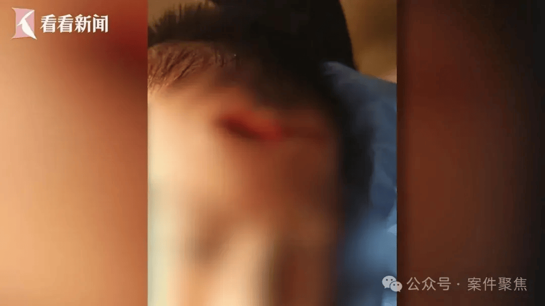血流不止，脸上缝30多针需整容！上海一知名火锅店发生意外，顾客和商家互相指责……