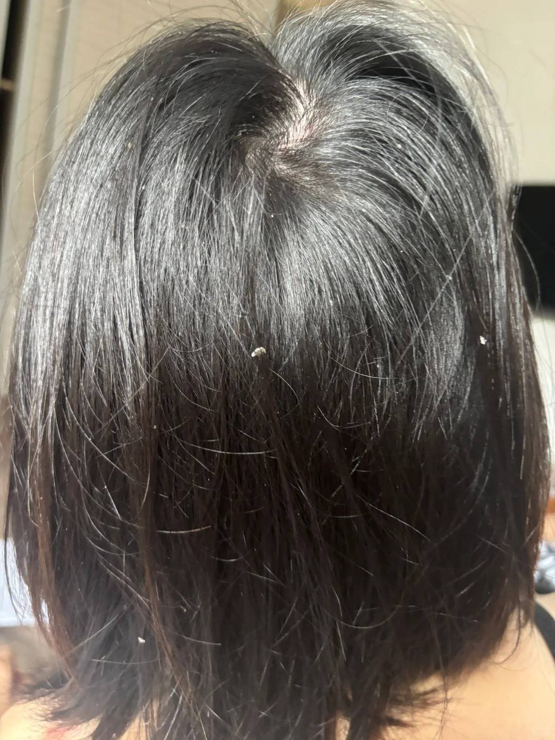 去屑止痒用什么洗发水效果好?控油防脱适用日常