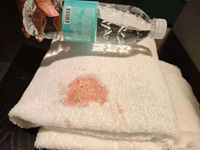 男子在成都希岸酒店使用浴巾发现大片血迹 担心染病要求赔偿(图1)