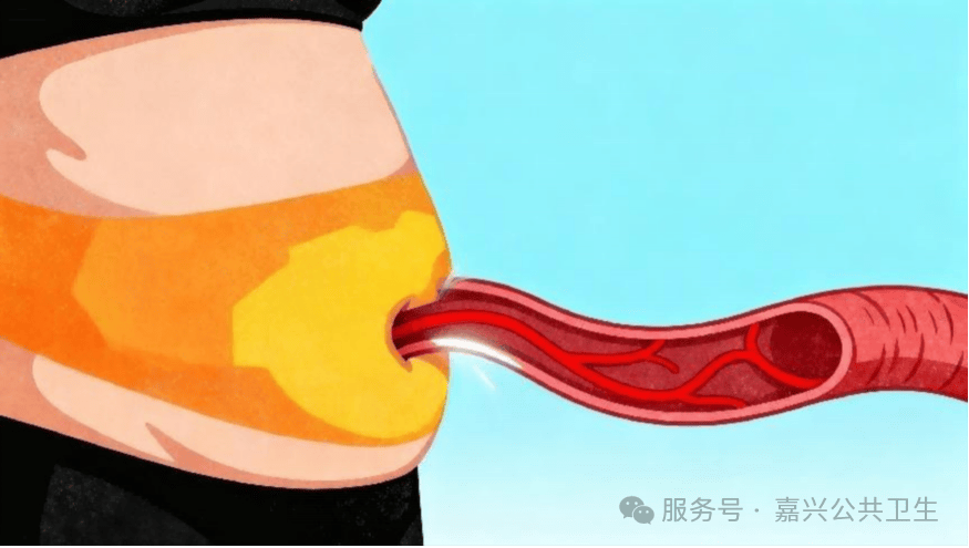全国高血压日 | 高血压必看的体重管理指南