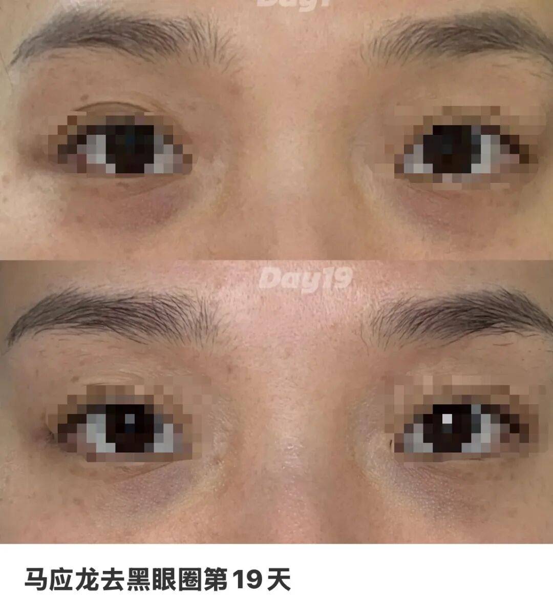 10块钱的小药膏，被年轻人用成贵妇医美