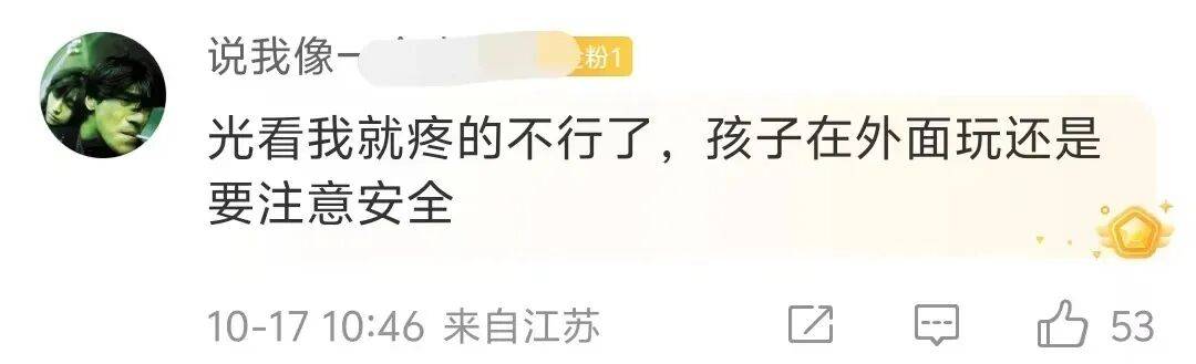 痛心！3岁男童不慎掉进炭火堆，全身85%烧伤，母亲徒手救出