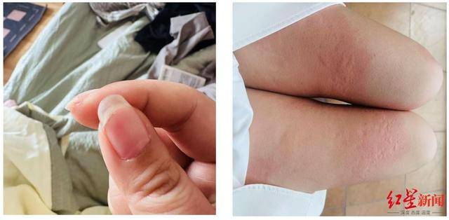 宽娱公司前员工称出差期间遭人性侵:男方被刑拘后不予起诉(图3)