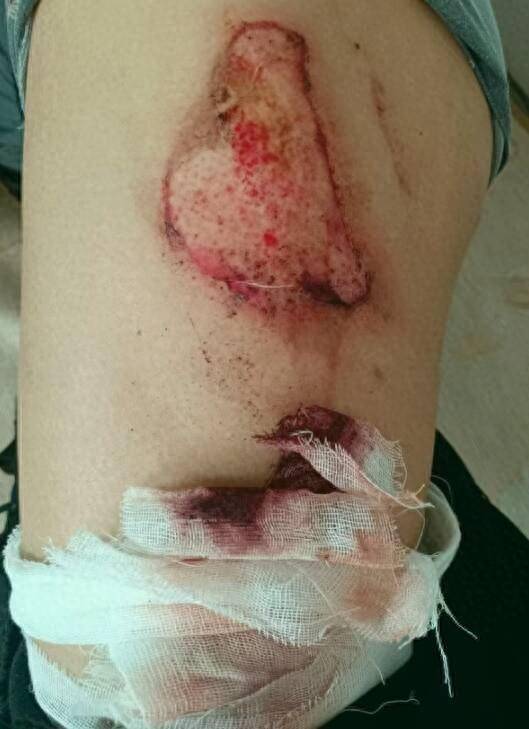 小米手机自燃责任谁说了算?售后称仅拍照、厂家称已鉴定(图1)