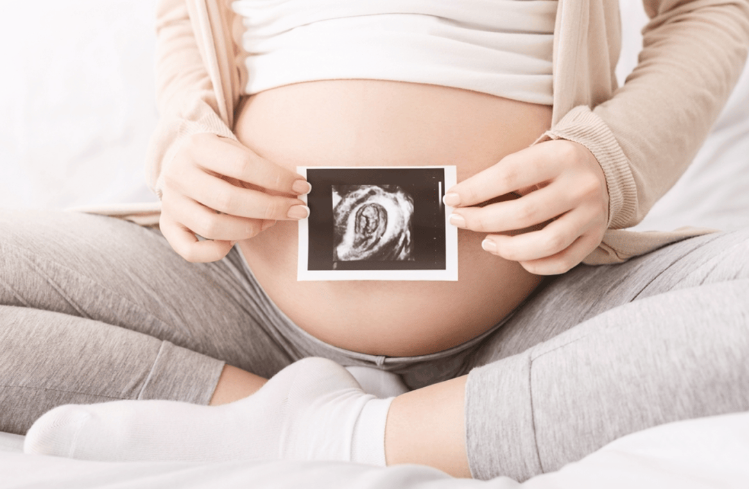 选择无痛分娩前,你最好知道的7件事