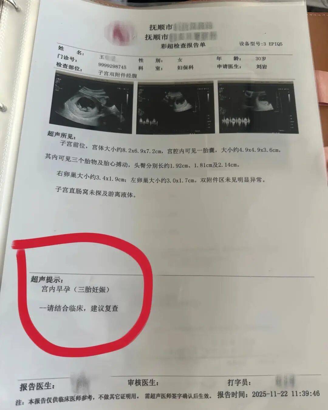 辽宁一孕妇两个月内从一胎变四胞胎