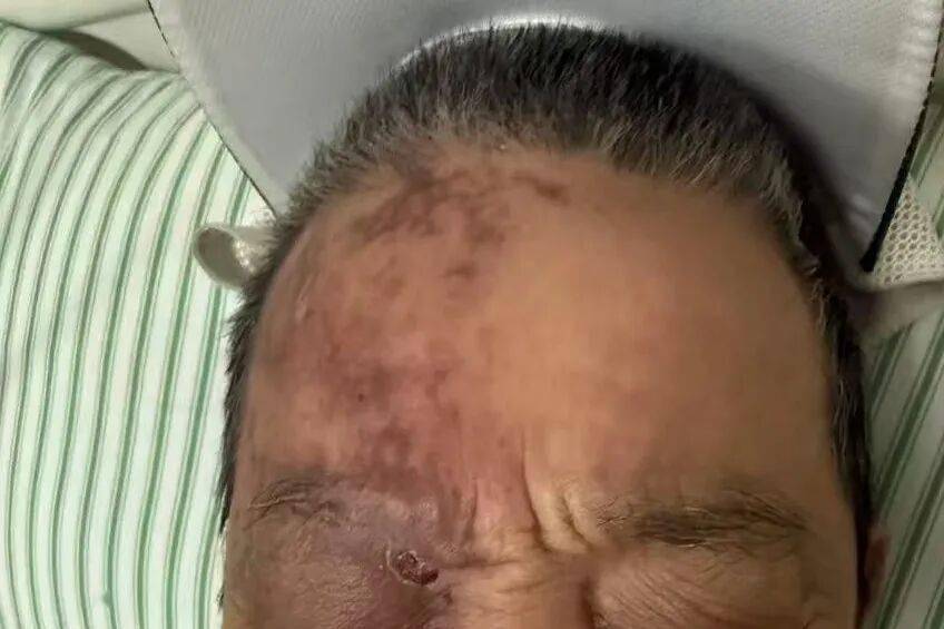 这种病毒90%的人可能感染