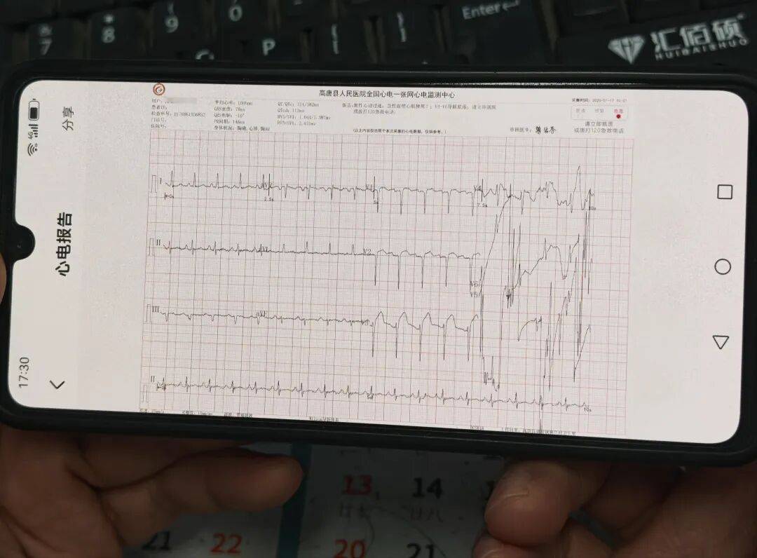 高唐：村医上传一张图，抢回心梗患者