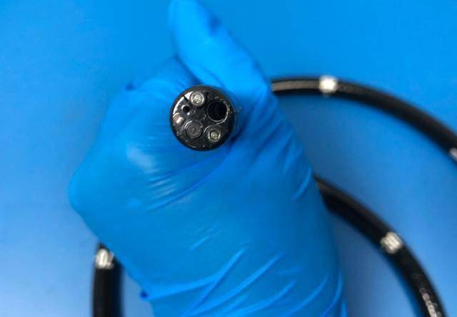 做一次肠镜，能管几年？在此期间一定不会得癌吗？4类人尽早筛查