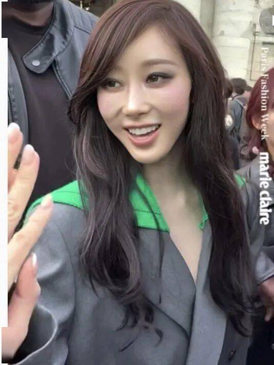 她因“惊艳蜕变”，引发整容猜测 插图2