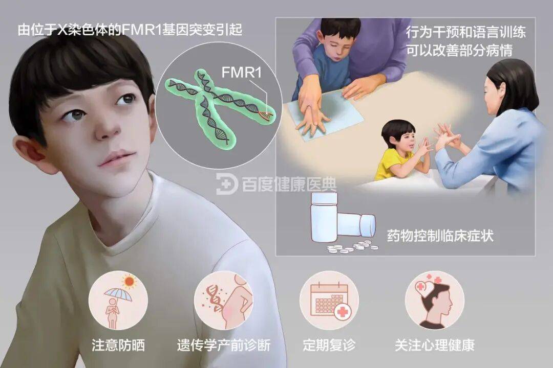 【科普】隐性第二大遗传性智力低下“杀手”——脆性X综合征