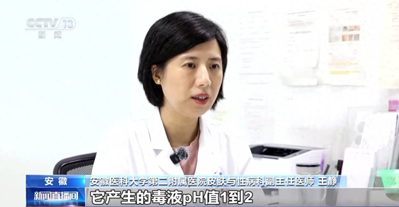 隐翅虫进入活跃期，医生提示：切勿拍打