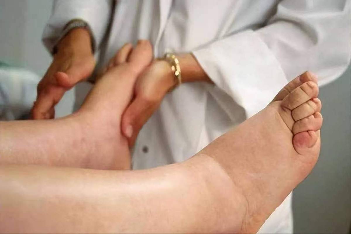 原创            20岁男孩确诊尿毒症！医生：一年前早有征兆,5个求救信号被忽视了